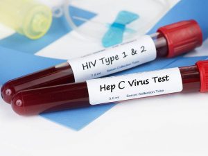 Как лечить гепатит и ВИЧ?