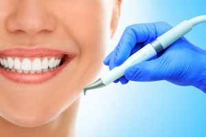 Особенности профессиональной чистки зубов