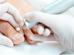 Что такое протезирование ногтя и когда его проводят
