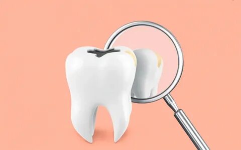 Кариес: как лечить заболевание зубов