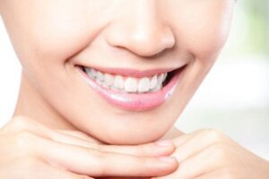 Что стоит знать об отбеливании зубов перед процедурой?