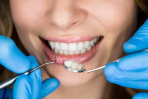 Способы эстетического лечения зубов