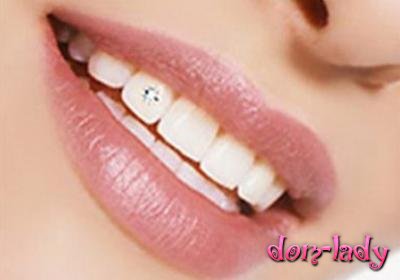 Художественная реставрация зубов: плюсы и минусы