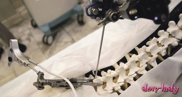 Российские ученые сообщили о создании более мощного и более дешевого хирургического робота, чем Да Винчи