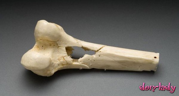 Ученые впервые вырастили кости в лаборатории