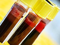 Исследователи научились обновлять кровь людей без донорского материала