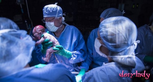 Впервые в США женщина с пересаженной маткой родила ребенка