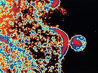 Ученые нашли антитело, нейтрализующее почти 90% штаммов ВИЧ