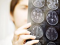 Новый метод поможет людям с повреждениями мозга