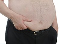 Парадокс ожирения - всего лишь миф, говорят эксперты