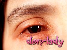Лекарство от аллергии поможет при повреждении зрительного нерва