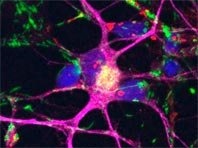 Витамин B3 предотвращает гибель нервных клеток при болезни Паркинсона