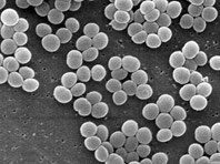 Биологи обнаружили новые бактерии, которые не боятся антибиотиков