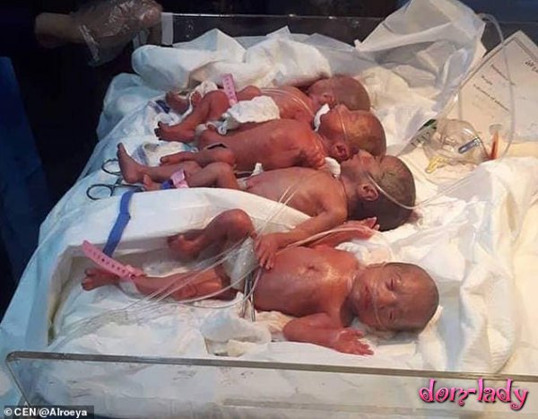 Женщина из Ирака второй в мире родила 7 детей