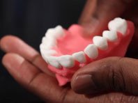 Ученые сконструировали зубной протез, предотвращающий воспаление десен